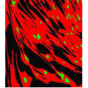 sluggish_8